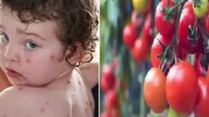 They Call This New Disease The Tomato Flu, And The Way It…